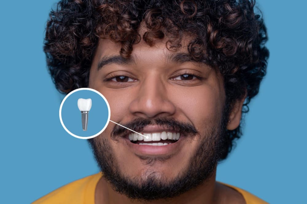 Implante dental